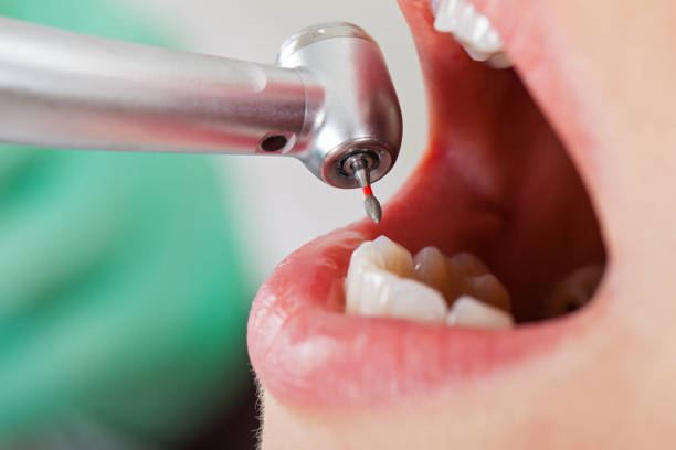 Best Weekend Emergency Dentist in Long Branch, VA